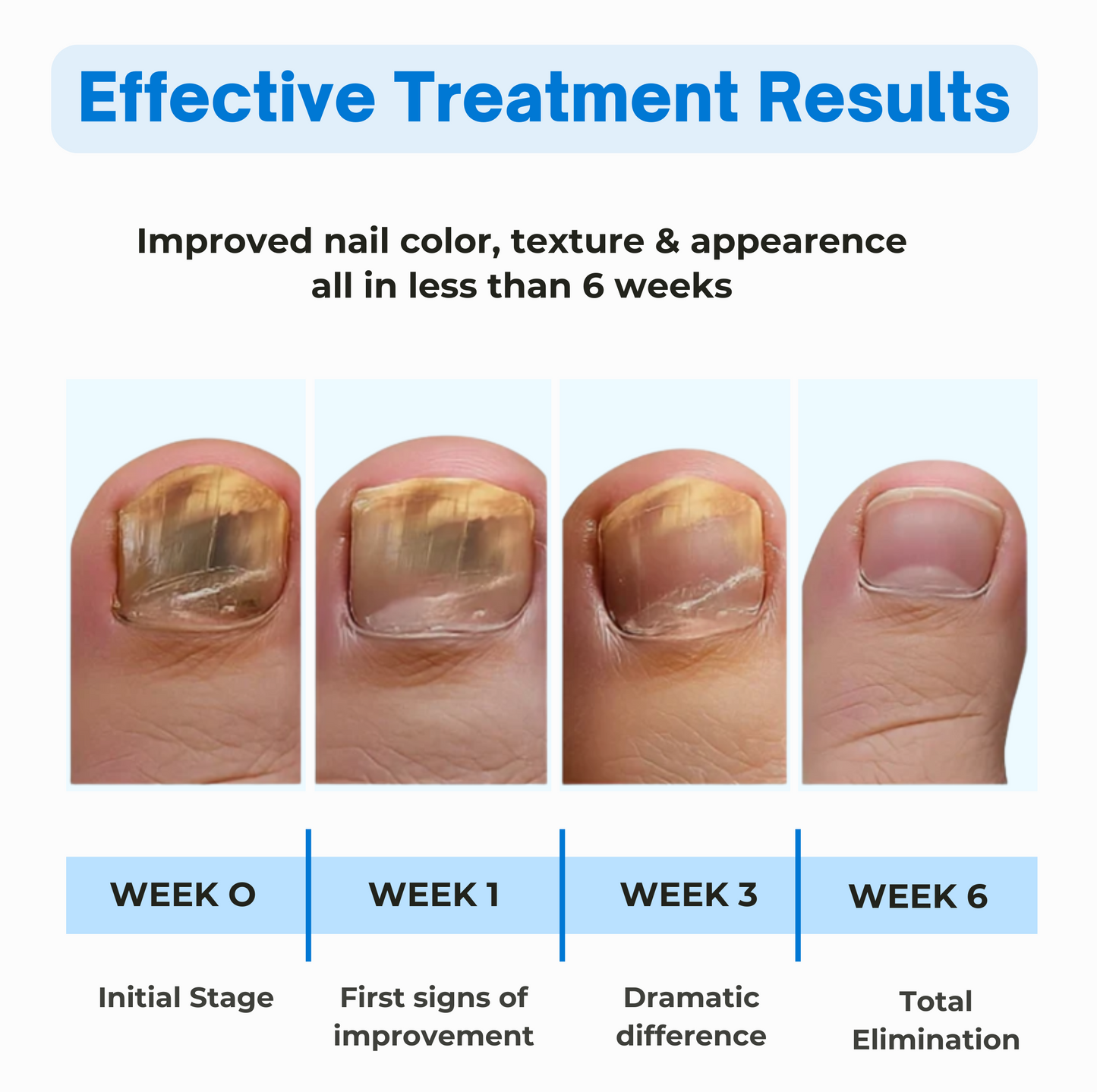 NailEase™ Fungal Nail Repair Patches – 21PCS